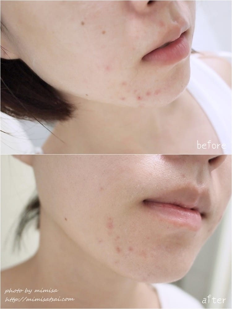 [保養] 來自加拿大的VIAN OCÉANE薇愛海洋冰川凍齡美肌系列