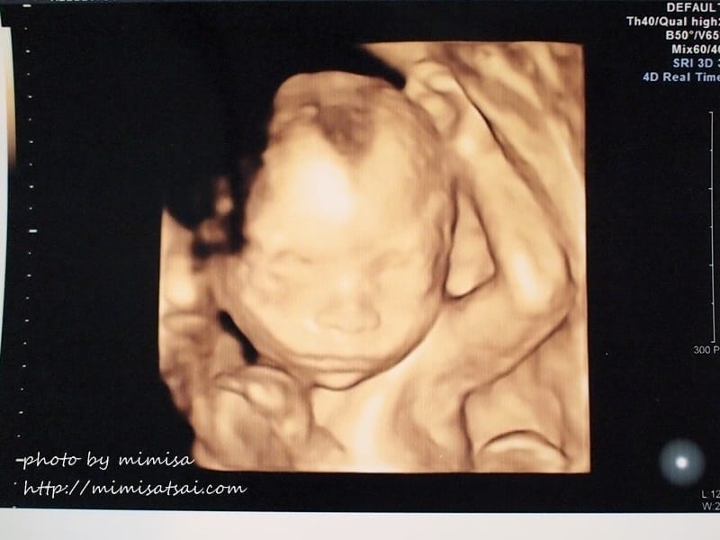 [孕日記] 小籽兒的性別之謎要揭曉囉!!!是雪兒還是賴虎呢???