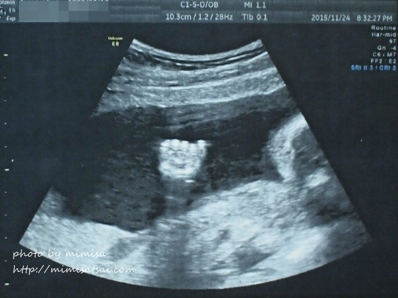 [孕日記] 小籽兒的性別之謎要揭曉囉!!!是雪兒還是賴虎呢???