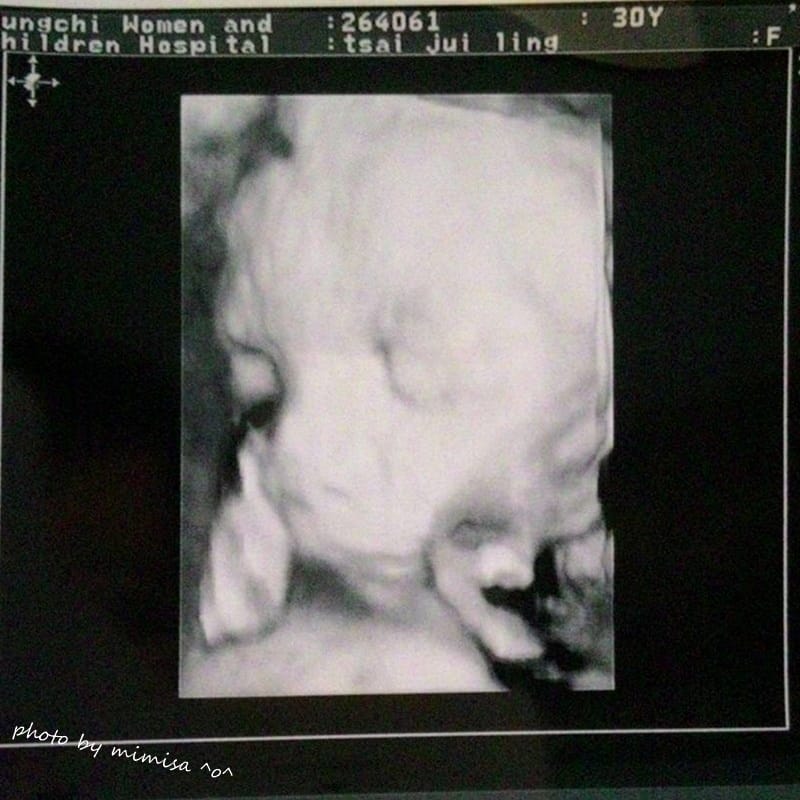 [孕日記] 邁入人生另一階段。默默地來到孕後期29W36W