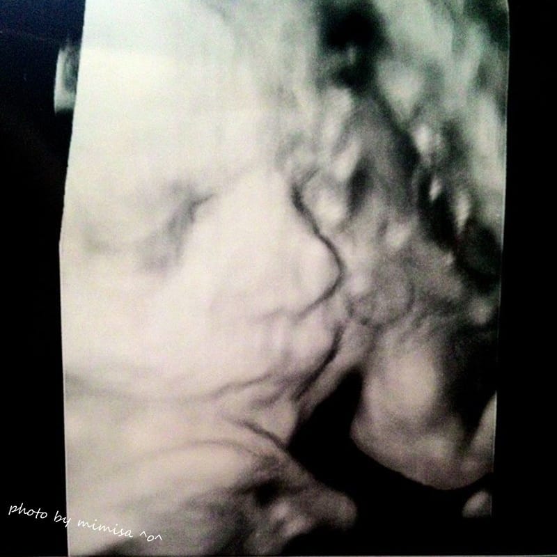 [孕日記] 邁入人生另一階段。默默地來到孕後期29W36W