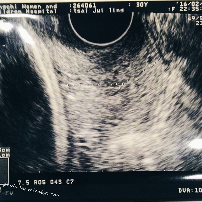 [孕日記] 邁入人生另一階段。默默地來到孕後期29W~36W