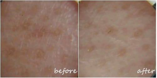 [保養] 孕婦敏感肌保養密技-新品科萊麗FIT音波洗臉機。當個美美的孕婦吧!!!