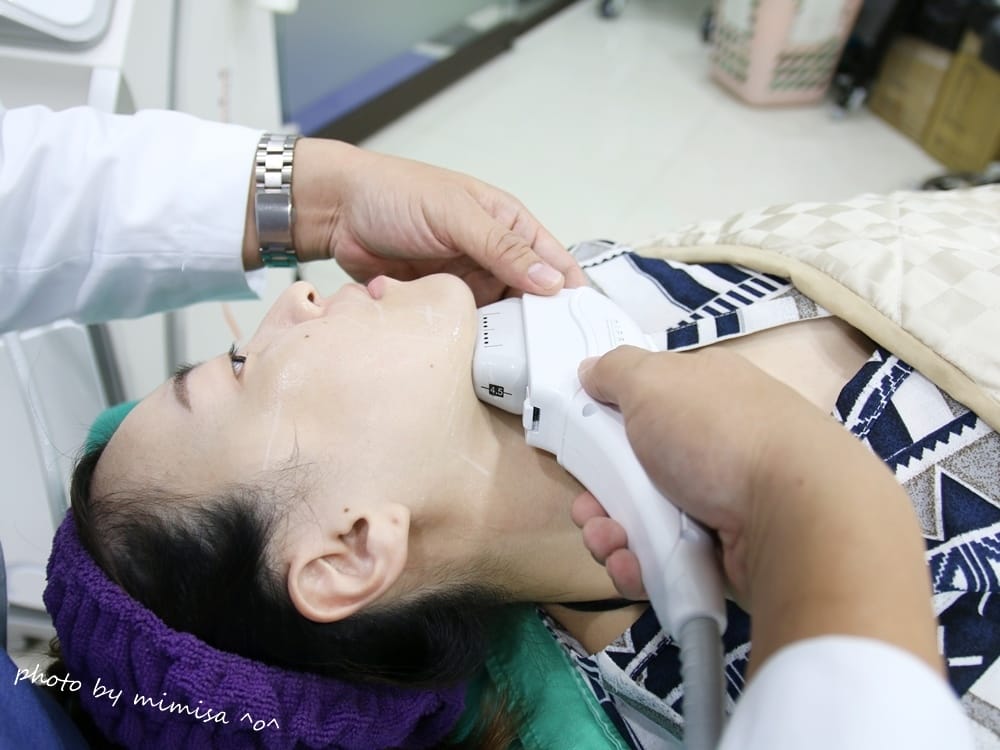 [醫美] 聖宜診所新竹店。V無痕音波讓我擺脫鬆垮老皮臉