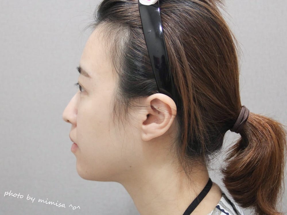 [醫美] 聖宜診所新竹店。V無痕音波讓我擺脫鬆垮老皮臉