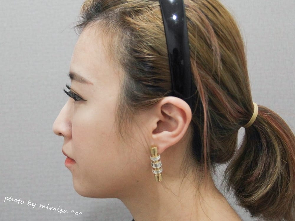 [醫美] 聖宜診所新竹店。V無痕音波讓我擺脫鬆垮老皮臉