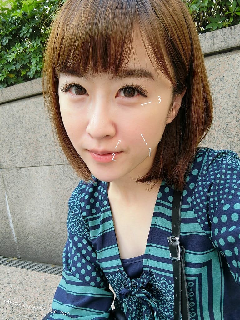 [醫美] 聖宜診所新竹店。V無痕音波讓我擺脫鬆垮老皮臉