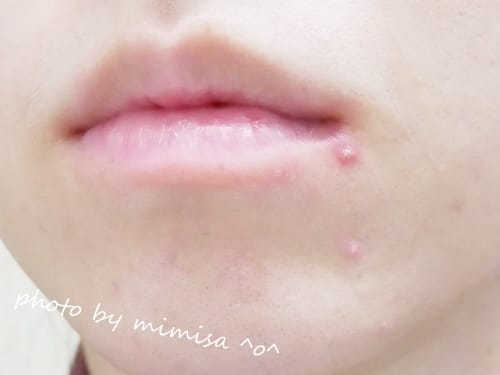 [保養] 寶拉珍選2%水楊酸精華液。陪我克服惱人的痘痘肌,恢復平滑亮澤肌