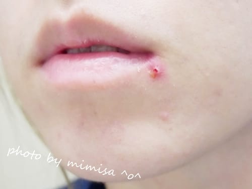 [保養] 寶拉珍選2%水楊酸精華液。陪我克服惱人的痘痘肌,恢復平滑亮澤肌