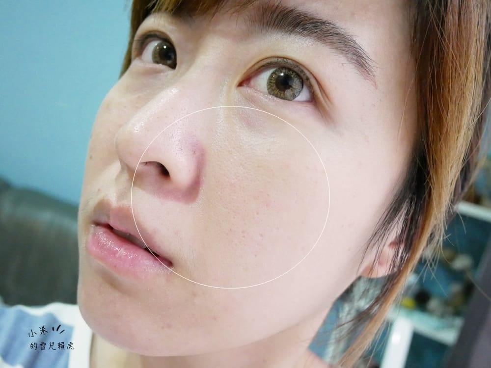 [醫美] 聖宜診所新竹店。讓皮秒雷射成就我的水煮蛋肌!!!