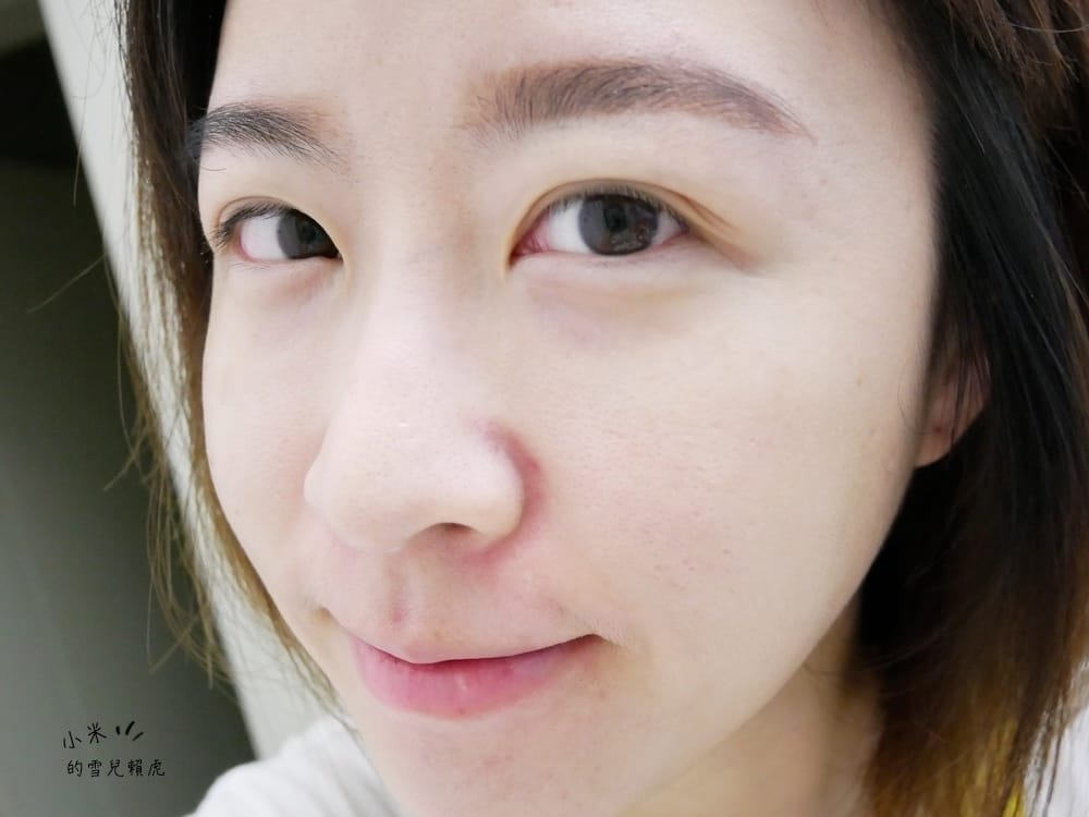 [醫美] 聖宜診所新竹店。讓皮秒雷射成就我的水煮蛋肌!!!