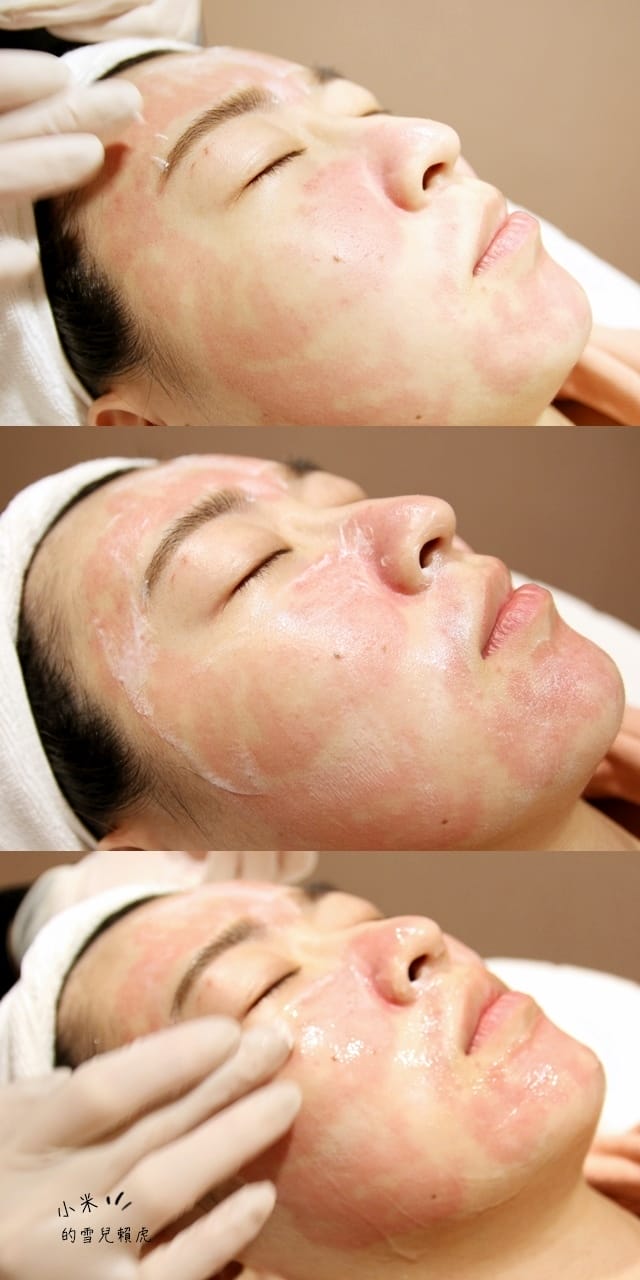 [醫美] 聖宜診所新竹店。讓皮秒雷射成就我的水煮蛋肌!!!