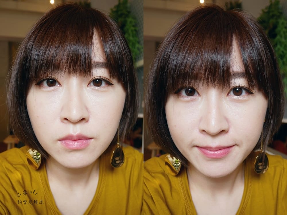 聖宜診所 電波 (18).jpg 聖宜診所 電波 (18).jpg