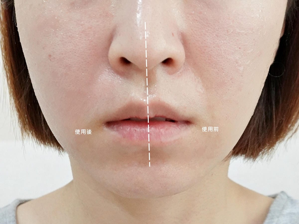 CurrentBody Skin 射頻美容儀 (23).jpg