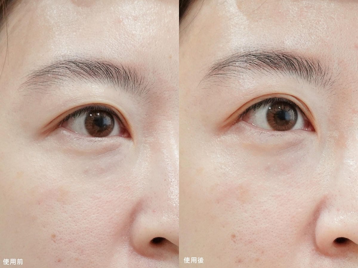 CurrentBody Skin 射頻美容儀 (25).jpg