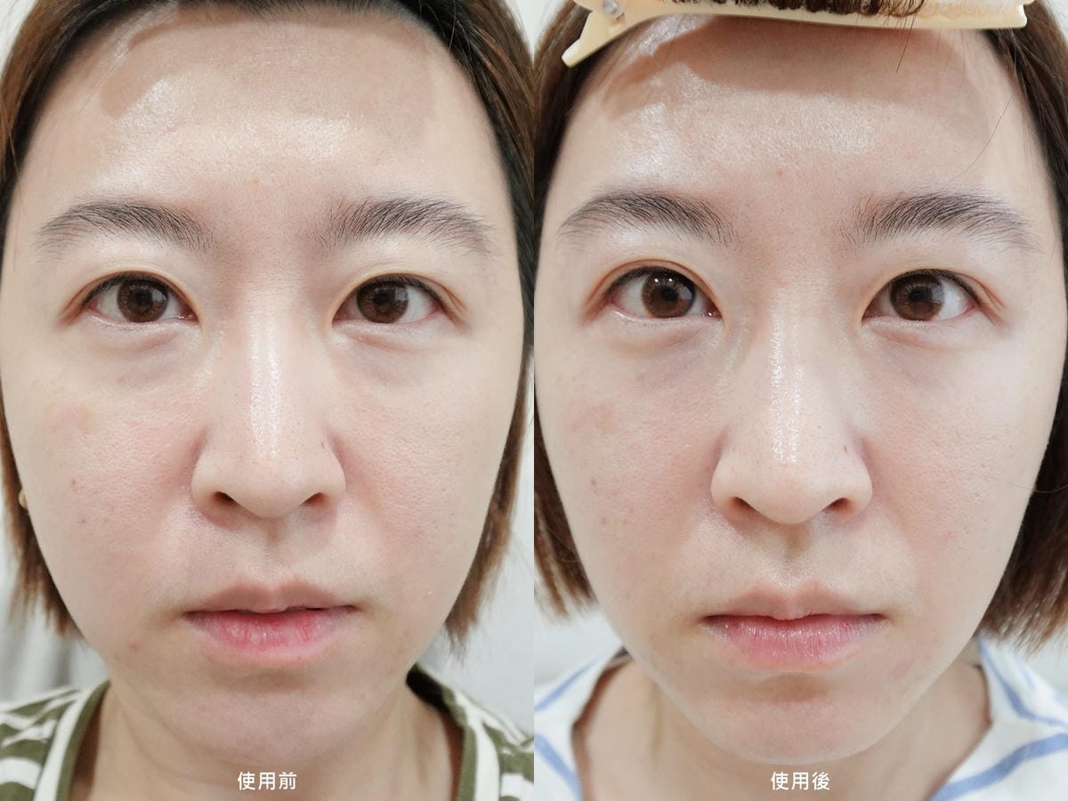 CurrentBody Skin 射頻美容儀 (24).jpg