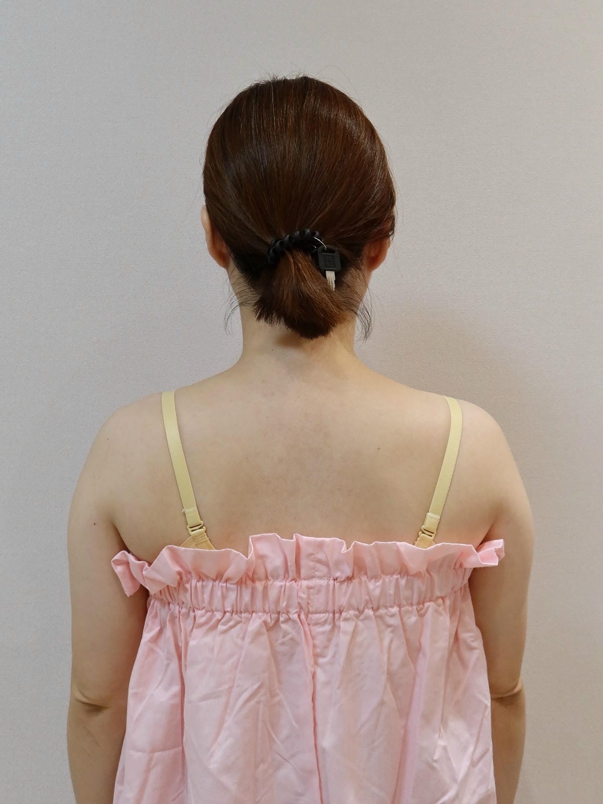琢月醫美瘦肩針 (14).JPG 琢月醫美瘦肩針 (14).JPG
