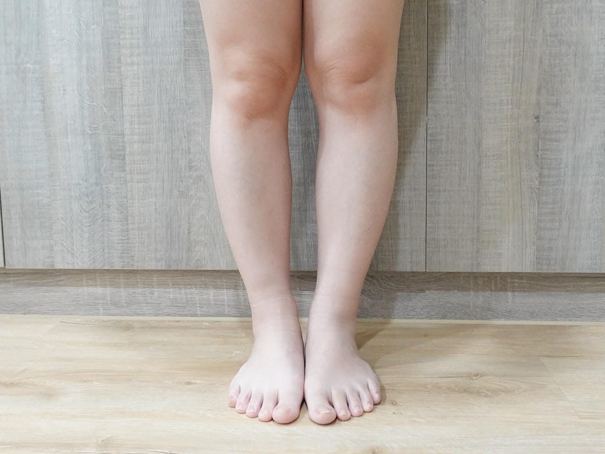悠美診所肉毒小腿 (16).jpg 悠美診所肉毒小腿 (16).jpg
